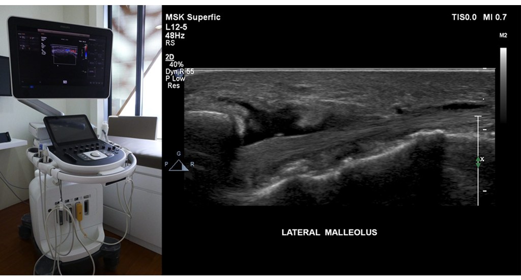 Bjios Ultrasound