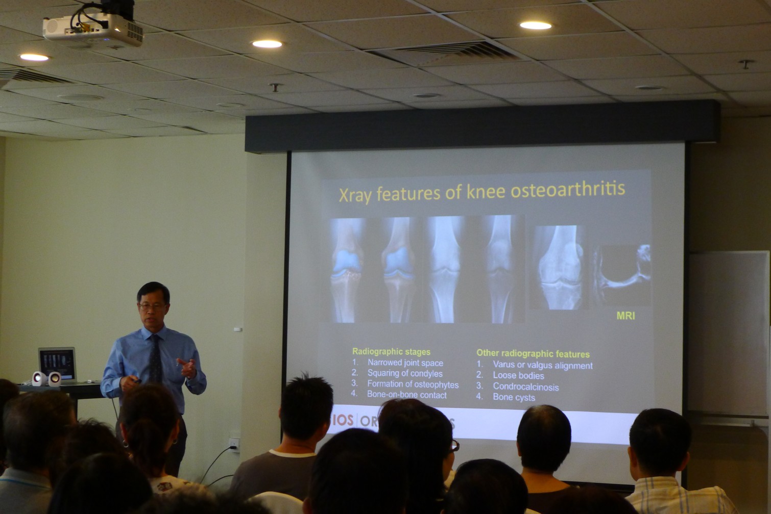 Bjios Osteoarthritic Knee What You Need To Know
